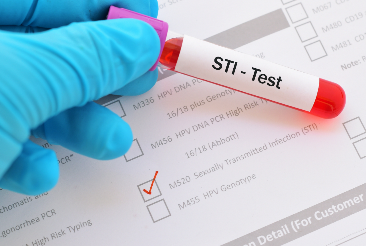 Sexually transmitted infections: diagnostic picture tests